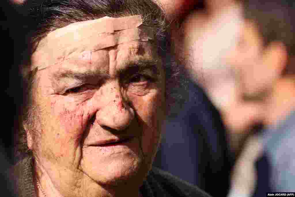 An elderly woman with a head wound waits to be registered as a refugee in Goris on September 27. The family was involved in a car accident as they were fleeing from Nagorno-Karabakh. A total of 192 Azerbaijani troops were killed and 511 were wounded during Azerbaijan’s offensive last week the country’s Health Ministry announced on September 27. Ethnic Armenian Nagorno-Karabakh officials said that at least 200 people on their side, including 10 civilians, were killed and over 400 were wounded in the fighting.