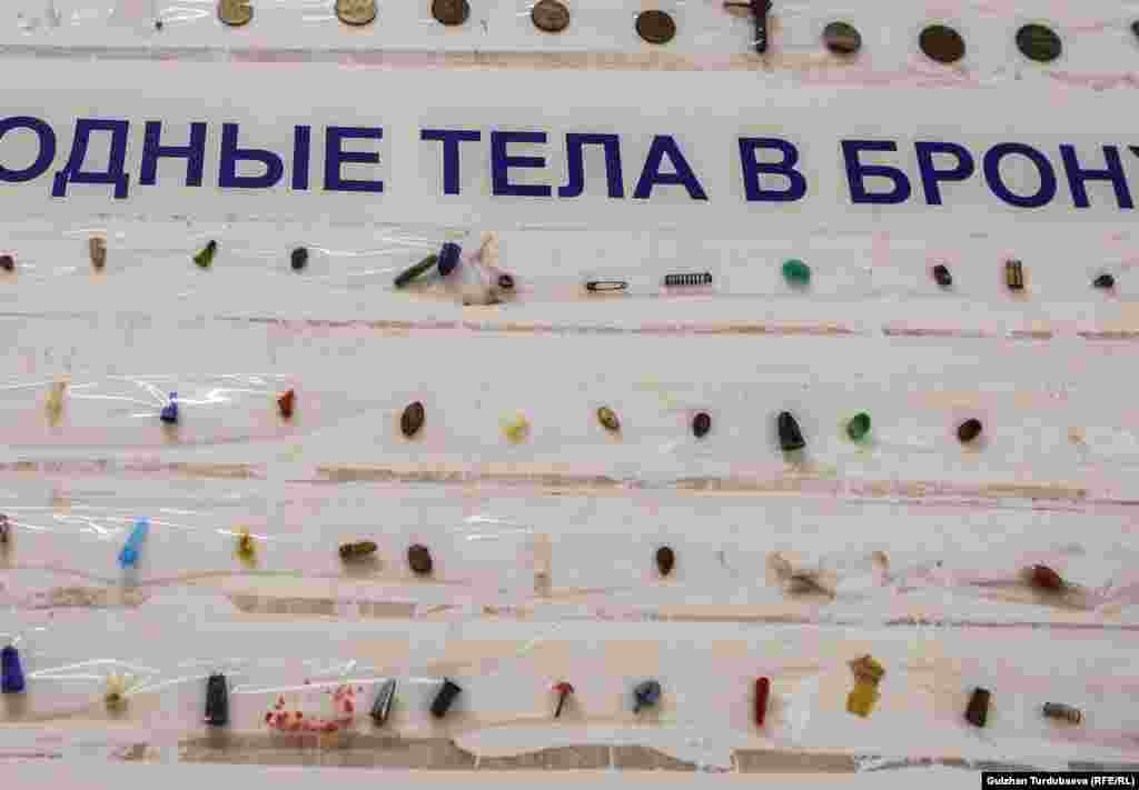Мелкие предметы извлекают из желудка и даже бронхов. 