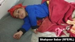 یک کودک مبتلا به بیماری سرخکان در شفاخانه ولایتی بادغیس