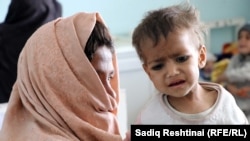 یکی از اطفال مبتلا به سوء تغذی که شفاخانه میرویس ولایت کندهار بستری است