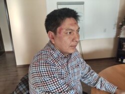 Болот Темиров после нападения.