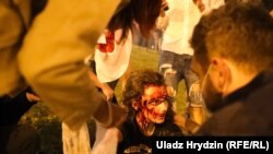 Потерпіла під час силового розгону мирної акції у Мінську в ніч на 10 серпня 2020 року. Білорусь