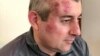 Сиражутдин Дациев. Фото Екатерины Сокирянской