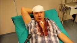 Slavo Kukić pretučen, tvrdi: Motivi napada politički